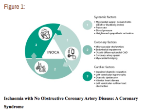 How to Diagnose and Manage Angina Without Obstructive Coronary Artery ...